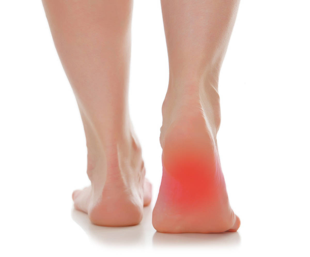 Patient Guidance: Three Easy Steps to Eliminating Heel Pain Without  Visiting a Doctor | Lower Extremity Review Magazine